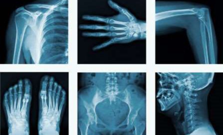 IMAGENOLOGIA MUSCULOESQUELÉTICA - 30h