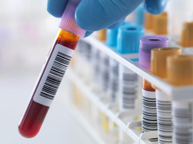 Imagen de portada para Curso online Recolección de muestras de laboratorio