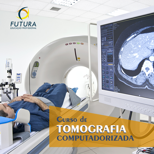 Imagem de capa para o Curso online Curso Online de Tomografia Computadorizada