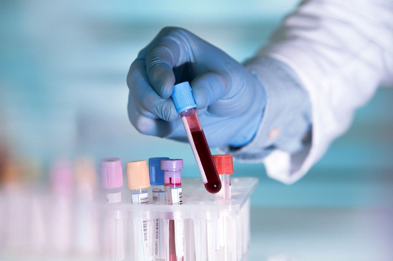 Curso Intensivo em Interpretação de Exames Laboratoriais