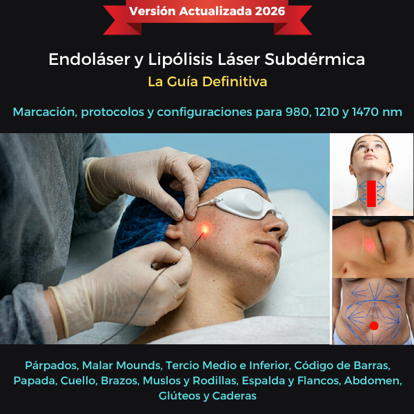 Endoláser y Lipólisis Láser Subdérmica - La Guía Definitiva - AyMd ...
