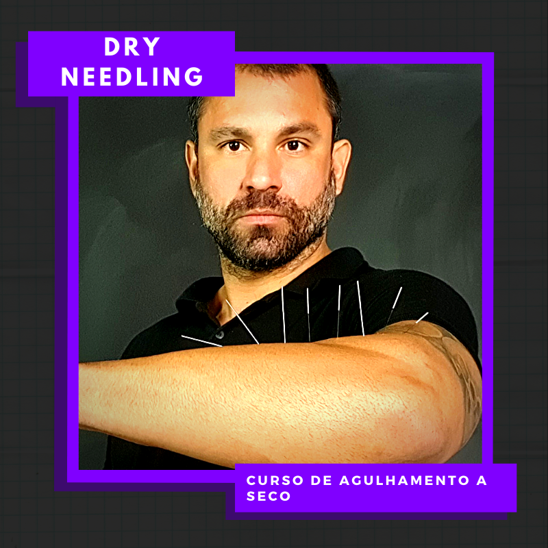 Aprenda Dry Needling Online