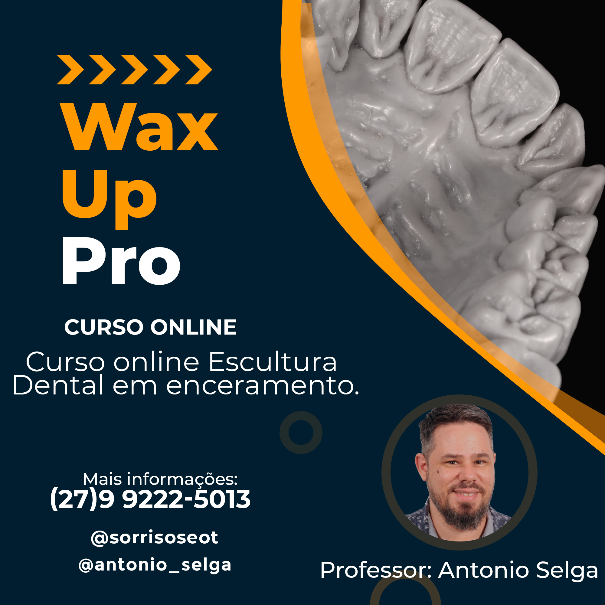Curso Online Escultura Dental em Enceramento