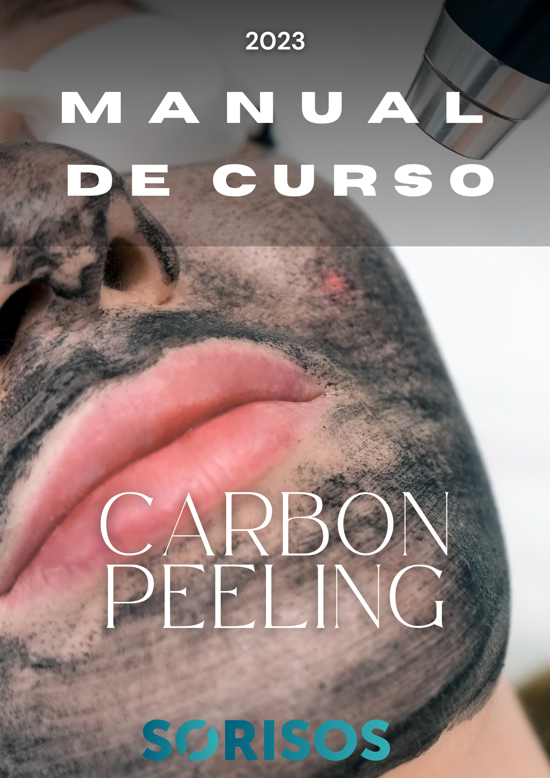 CARBON PEELING A LASER ( PEELING A LASER COM PASTA DE CARVÃO) - MANUAL DE CURSO