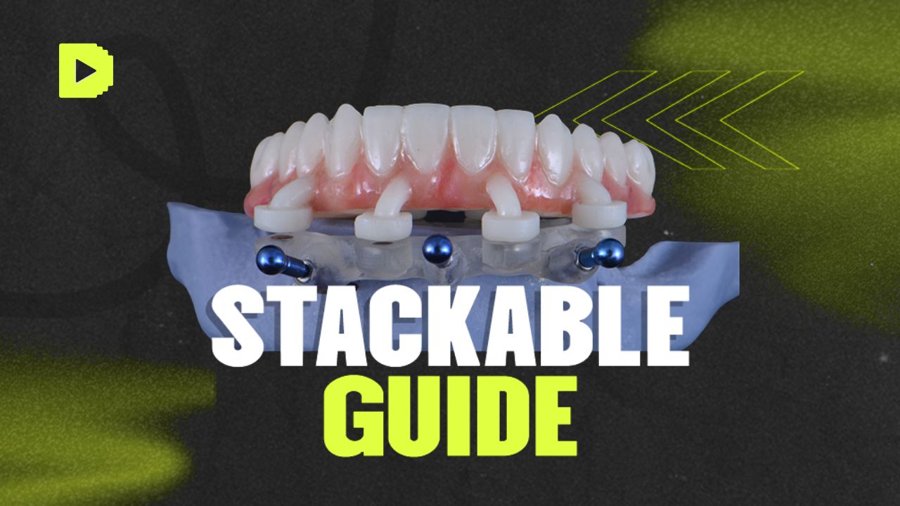 Stackable Guide Real Guide Stackable Guides - Pedro Duarte | Hotmart