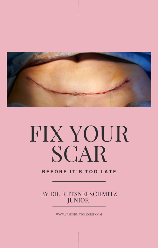 Fix Your Scar Before It's Too Late Rutsnei Schmitz, M.D. Specialist