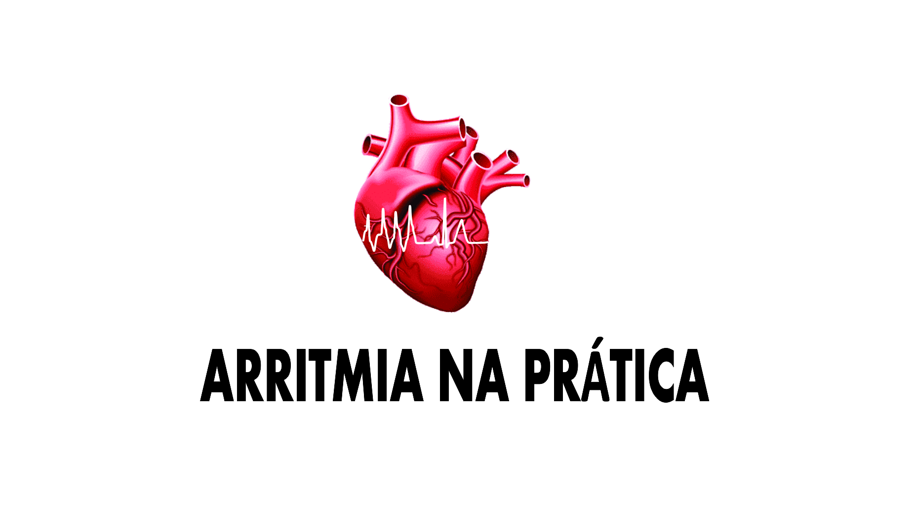 Curso de arritmia e eletrocardiograma do Arritmia Na Prática