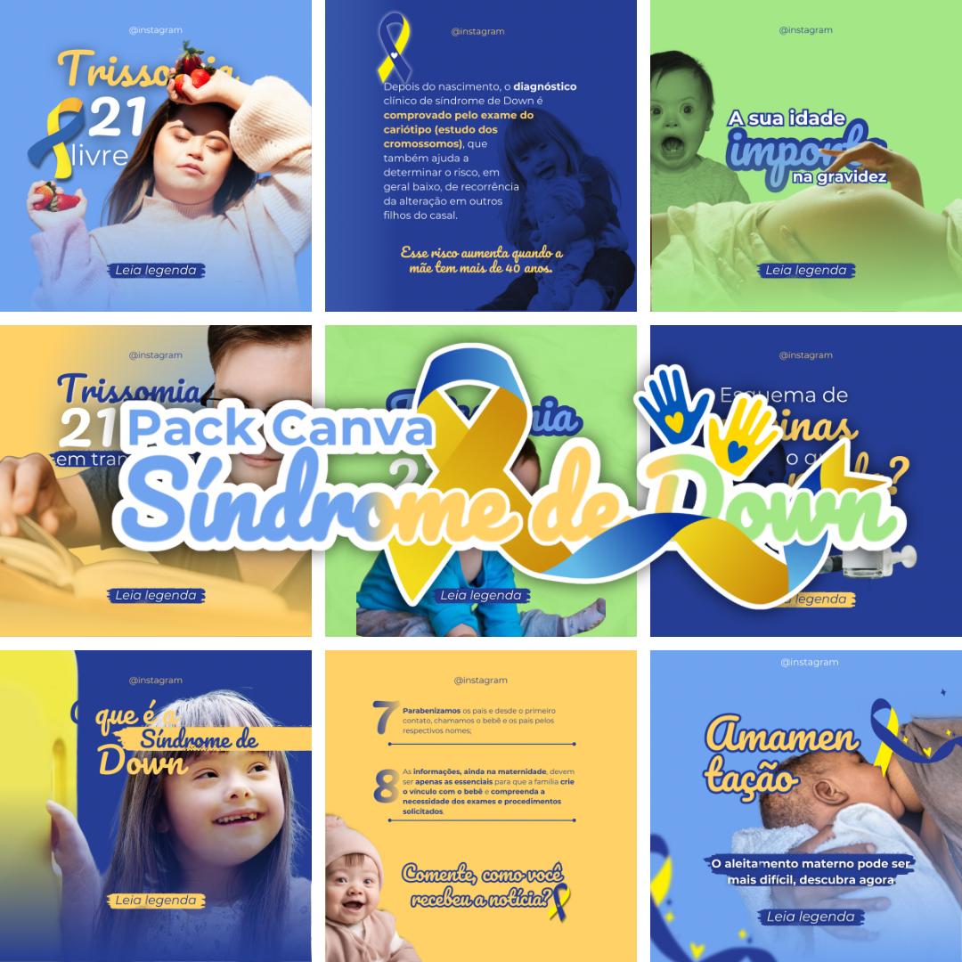 canva-s-ndrome-de-down-tatiane-tamara-de-oliveira-silva-hotmart