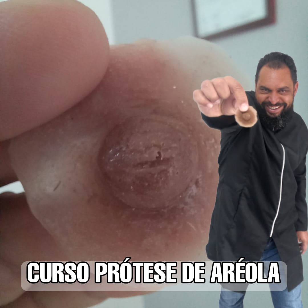 Curso  Prótese de Aréola em Silicone