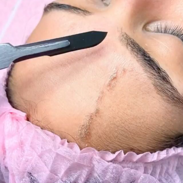 Curso de Dermaplaning, 8 mil por mês