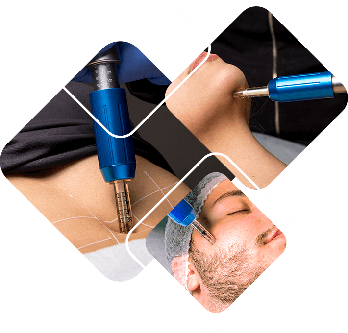 Curso Aplicação de Enzimas sem Agulhas