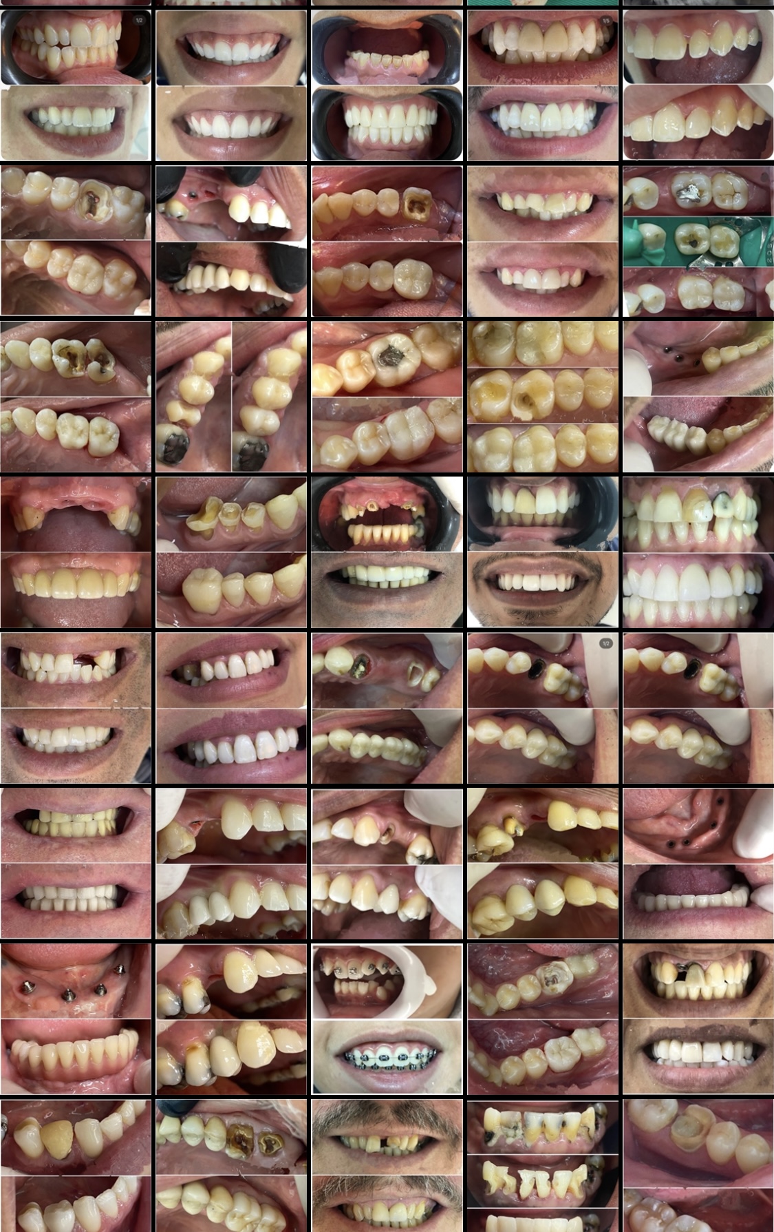 FOTOS DE ANTES x DEPOIS DENTISTA 