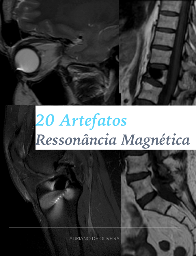 20 Artefatos Resson ncia Magn tica Adriano De Oliveira Silva
