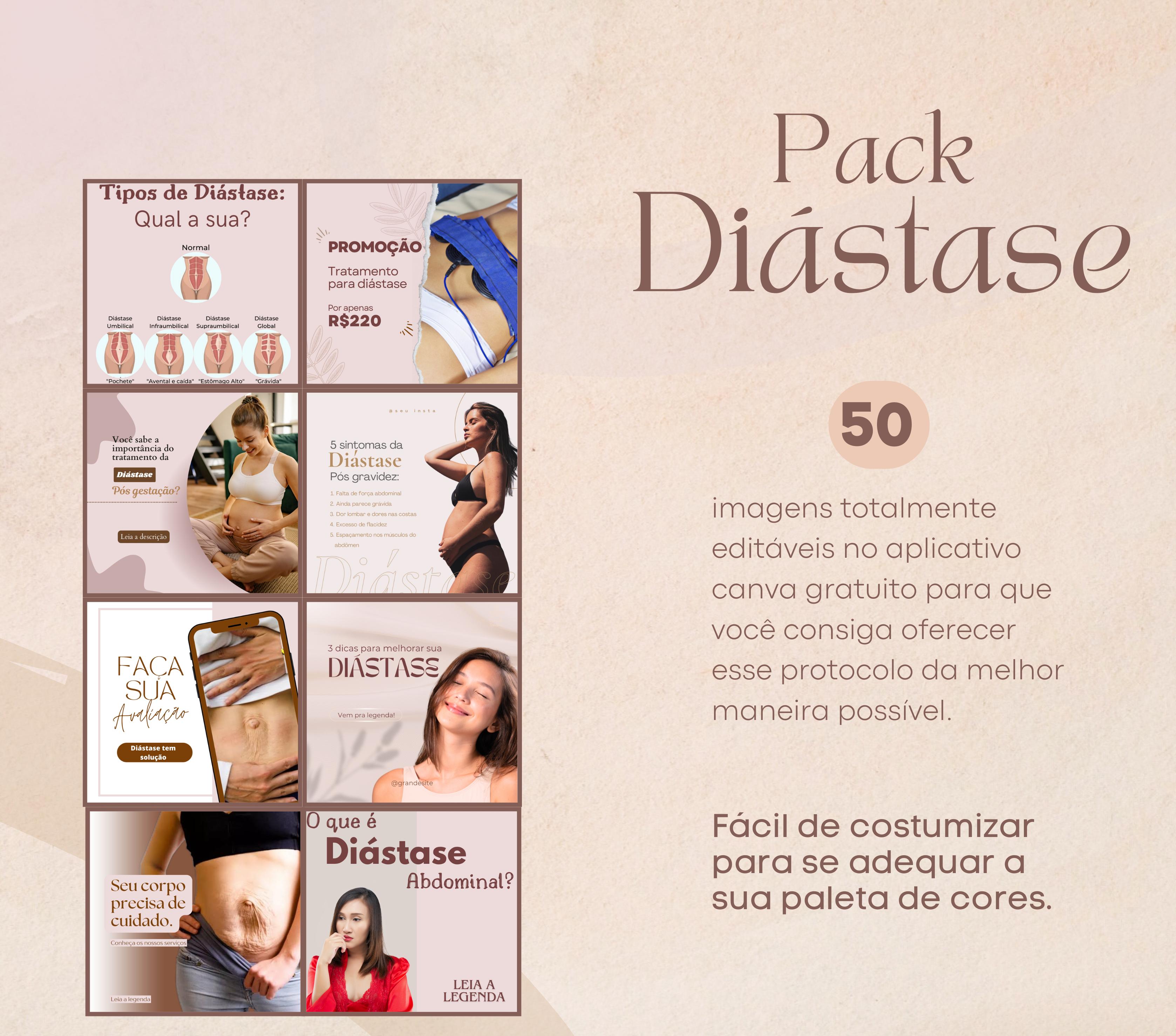 Imagem de capa para o Curso online Pack Diástase