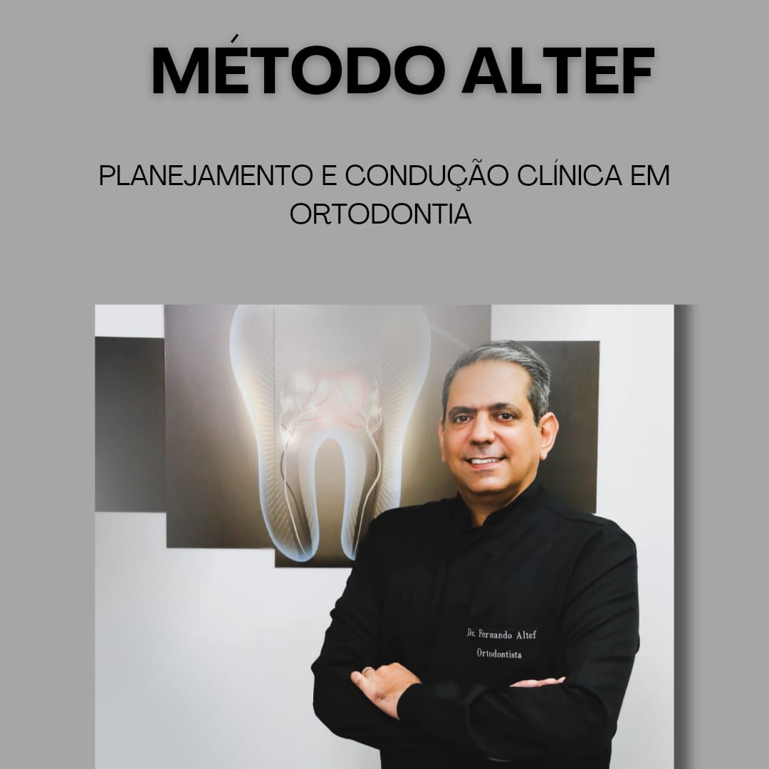 MÉTODO ALTEF : Planejamento e Condução Clínica em Ortodontia - Fern...