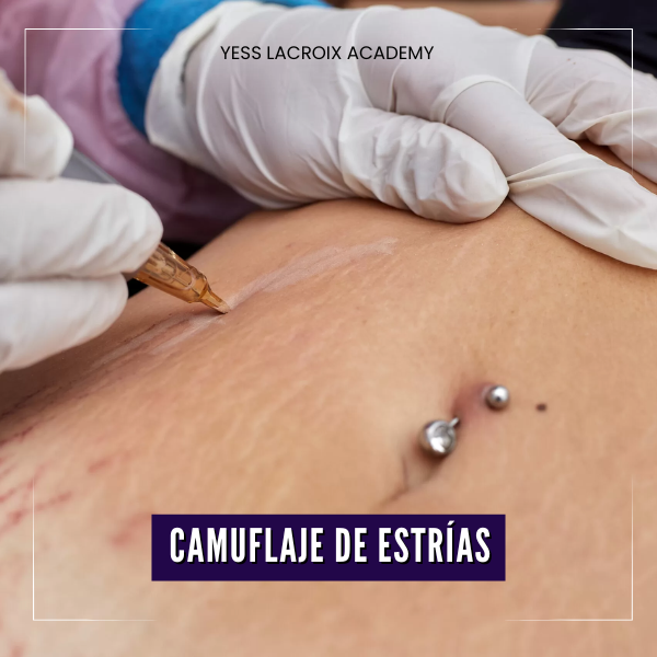 Imagen de portada para Curso online 🎓CAMUFLAJE DE ESTRÍAS YESS LACROIX