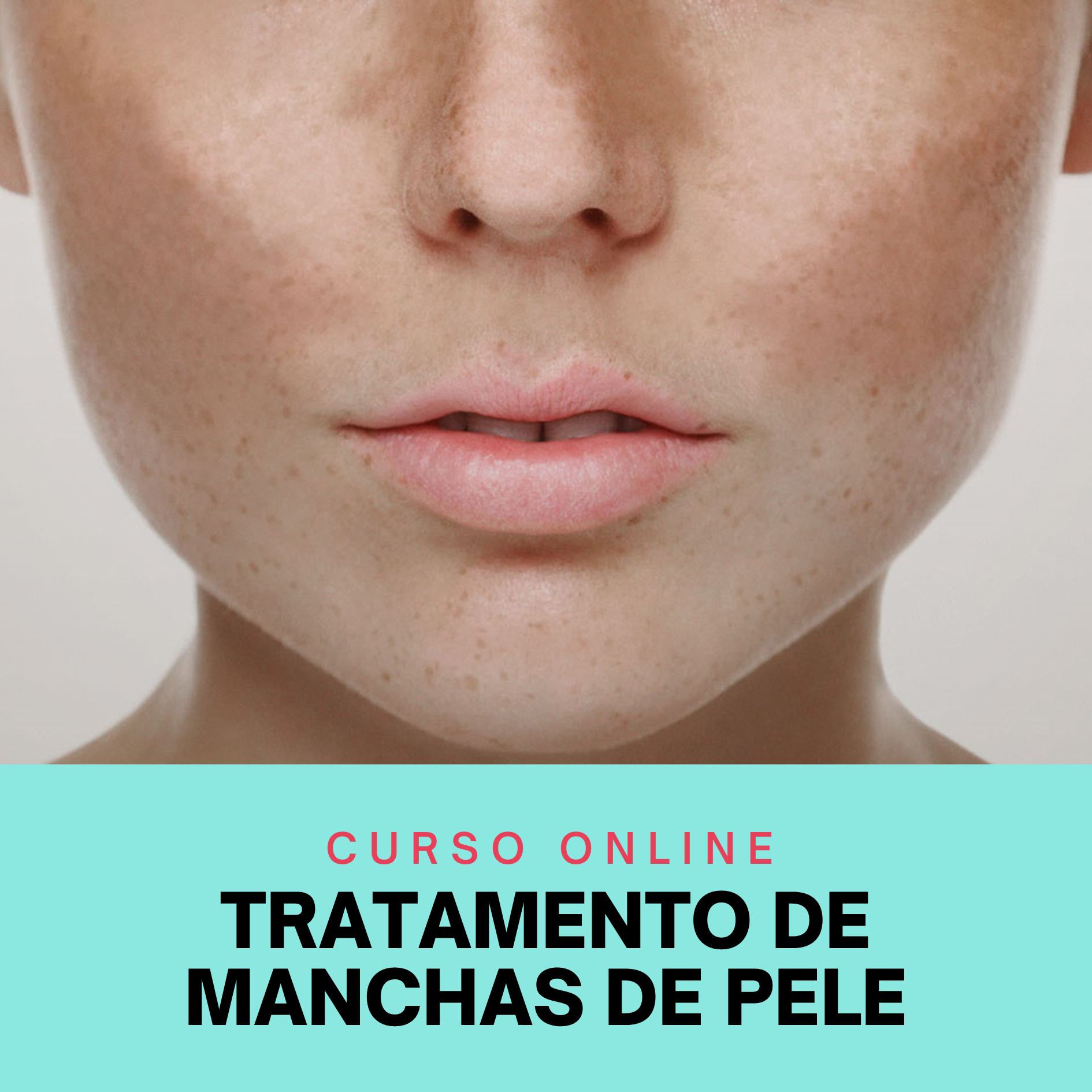 Curso de Tratamento de Manchas de Pele