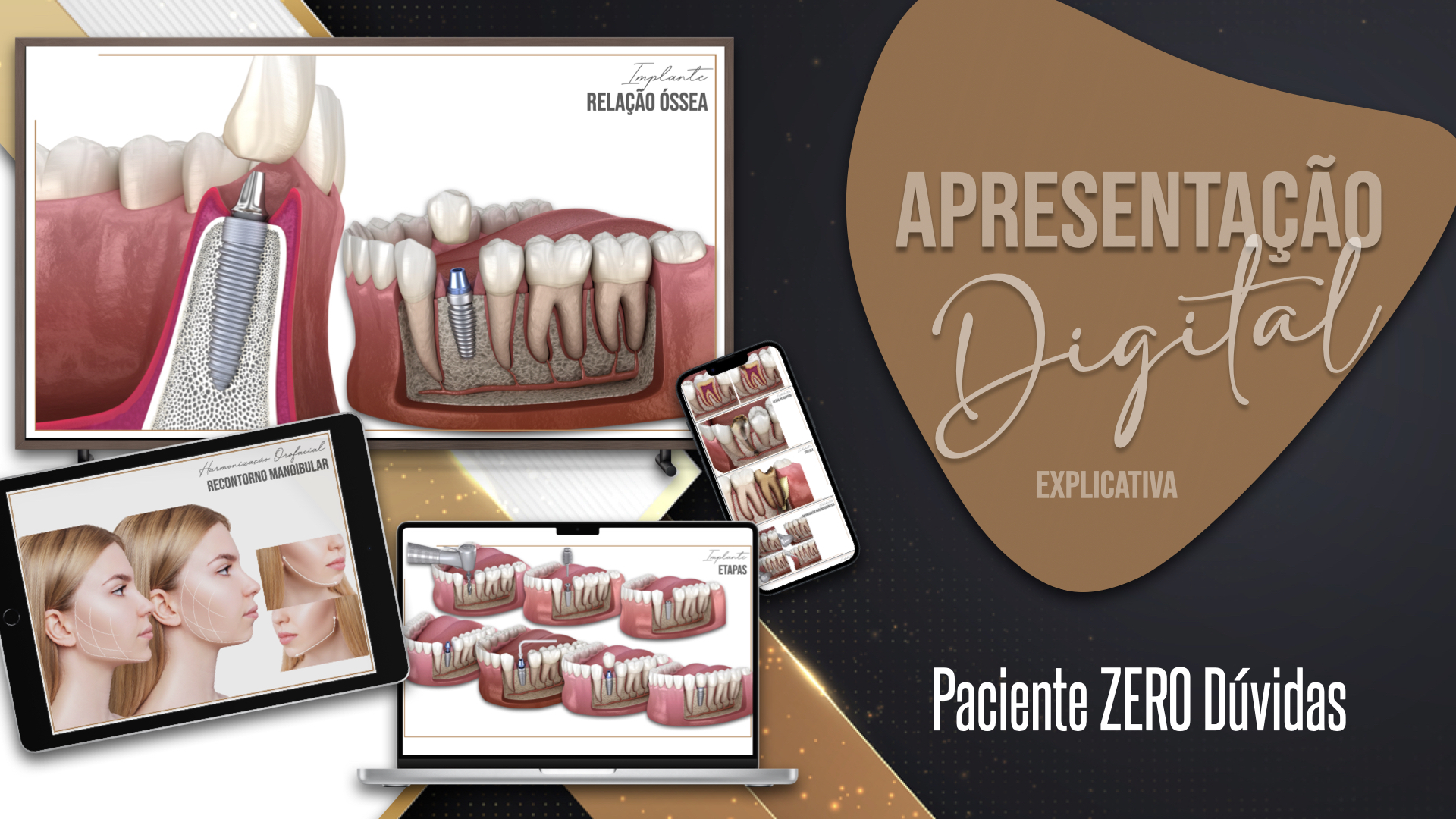 Paciente ZERO Dúvidas, para dentistas. - Vitor Enrique Bini | Hotmart