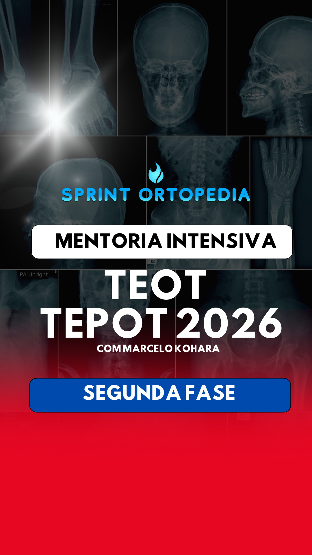 Teot MENTORIA INTENSIVA PARA O TEOT 2026- SEGUNDA FASE - Sprint Ortopedi...