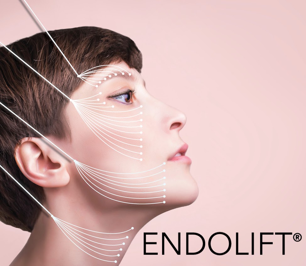 Material Curso: Endolaser / Endolift Teorico