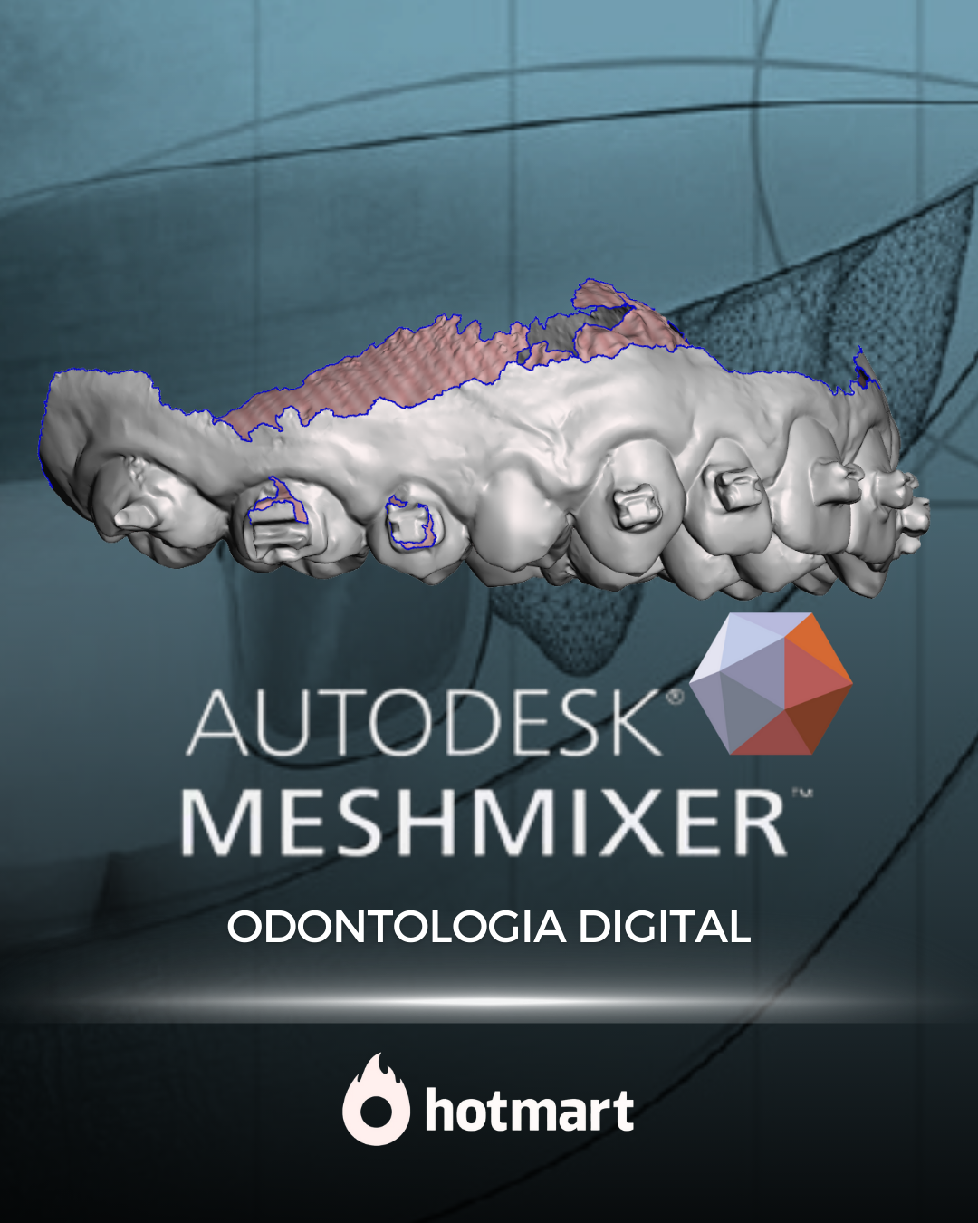 Stackable Guide Meshmixer Meshmixer para Odontologia - AMANDA ANTUNES PIMENTEL | Hotmart