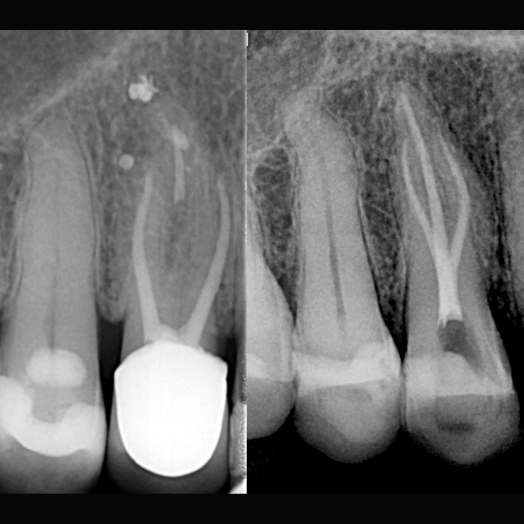 Forma o Em Endodontia Cl nica forma-o-em-endodontia-cl-nica