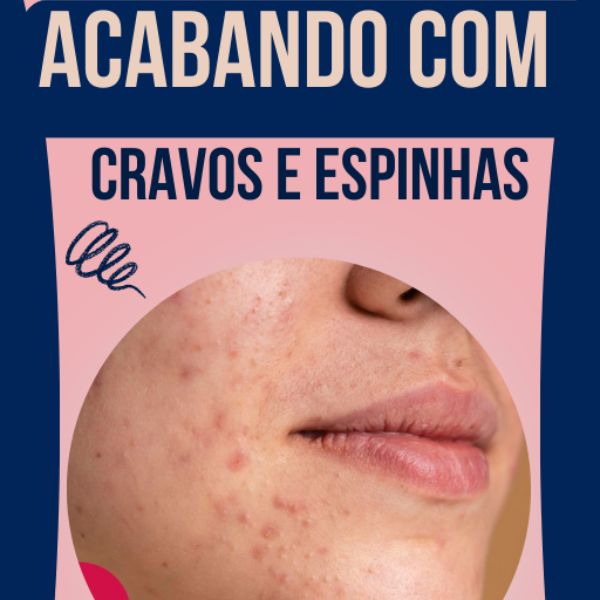 "Peles em Transformação: Conquistando uma Pele Livre de Cravos e Espinhas"