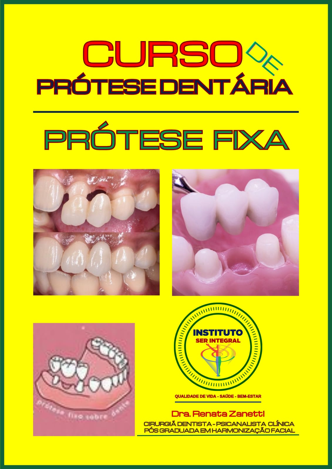 Curso de Prótese Dentária Fixa - Renata Zanetti | Hotmart