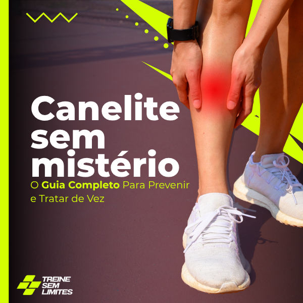 Canelite Sem Mistério: O Guia Completo Para Prevenir e Tratar de Ve...