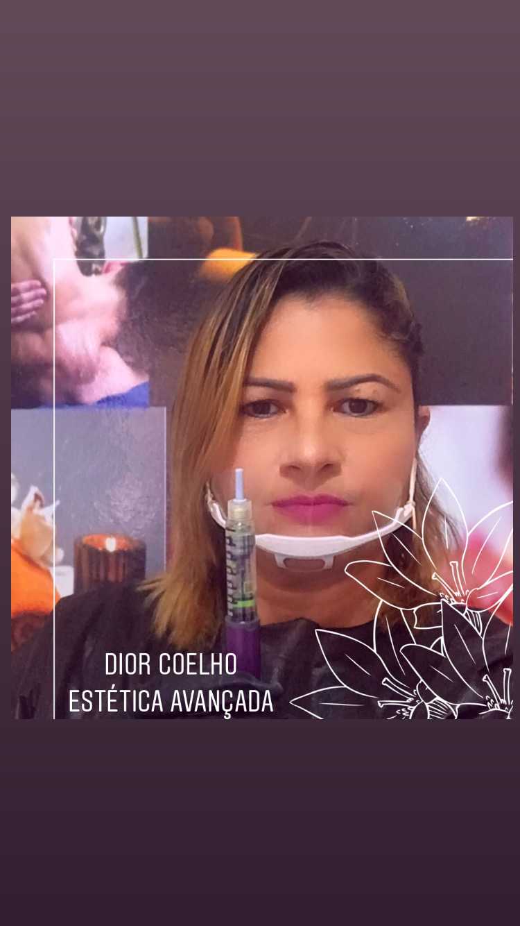 Dior Coelho